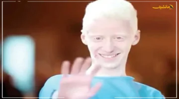 من معاناة التنمر إلى الشاشة.. قصة طفل نوبي مصاب بالألبينو يحول تحدياته إلى إلهام مع فيلم «ضي» 1